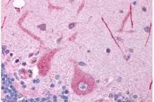 Human Brain, Cerebellum (formalin-fixed, paraffin-embedded) stained with FOXE3 antibody ABIN214754 at 5 ug/ml followed by biotinylated goat anti-rabbit IgG secondary antibody ABIN481713, alkaline phosphatase-streptavidin and chromogen. (FOXE3 抗体  (AA 235-284))