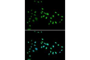 Immunofluorescence analysis of A549 cell using DNMT3A antibody. (DNMT3A 抗体)