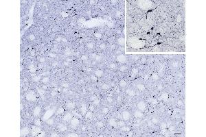 (ABIN184662) (scale bar: 50 μm, inset: 20 μm) immunostaining of NOS1 neurons in cryosection of a perfusion-fixed (4 % PFA) mouse caudate-putamen. (NOS1 抗体  (C-Term))