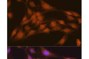 Immunofluorescence analysis of C6 cells using NRBF2 Polyclonal Antibody at dilution of 1:100. (NRBF2 抗体)