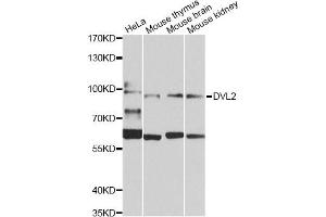 Western blot analysis of extracts of various cell lines, using DVL2 Antibody (ABIN5975825) at 1/1000 dilution. (DVL2 抗体)