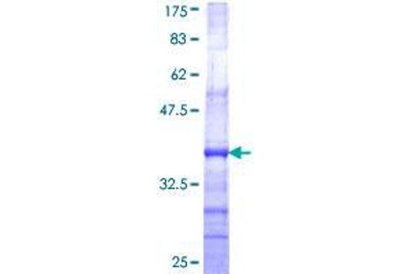 CLLD6 Protein (AA 97-196) (GST tag)