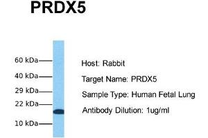 Host: Rabbit Target Name: PRDX5 Sample Tissue: Human Fetal Lung Antibody Dilution: 1. (Peroxiredoxin 5 抗体  (Middle Region))