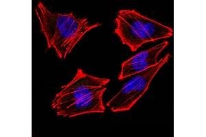 Confocal Immunofluorescent analysis of A2058 cells using AF488-labeled Isotype Control Monoclonal Antibody (IgG2a) (Green). (S100B 抗体)