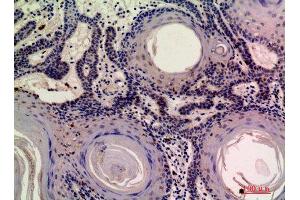 Immunohistochemistry (IHC) analysis of paraffin-embedded Human Skin, antibody was diluted at 1:200. (MOB3A/B 抗体)