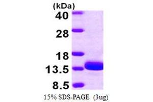SDS-PAGE (SDS) image for Thiosulfate Sulfurtransferase (Rhodanese)-Like Domain Containing 1 (TSTD1) (AA 1-115) protein (His tag) (ABIN667378) (TSTD1 Protein (AA 1-115) (His tag))