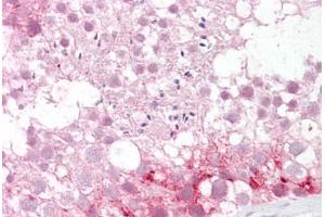 Anti-ABCD3 / PMP70 antibody IHC staining of human testis. (PMP70 抗体  (AA 526-539))