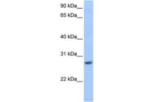 Western Blotting (WB) image for anti-Glutathione S-Transferase mu 3 (Brain) (GSTM3) antibody (ABIN2463566) (GSTM3 抗体)
