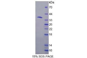 SDS-PAGE analysis of Mouse NP Protein. (PNP 蛋白)