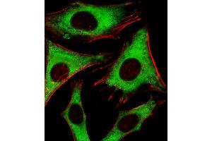Fluorescent image of Hela cells stained with RPLP0P6 Antibody (N-term) (ABIN1881762 and ABIN2843386). (RPLP0P6 抗体  (N-Term))