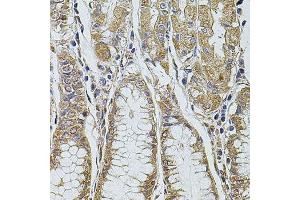Immunohistochemistry of paraffin-embedded human stomach using PDCD6IP antibody.