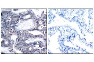 Image no. 3 for anti-Mitogen-Activated Protein Kinase Kinase 2 (MAP2K2) (pThr394) antibody (ABIN196623) (MEK2 抗体  (pThr394))
