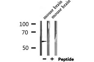 Western blot analysis of extracts from mouse brain, using TRIM21  Antibody. (TRIM21 抗体  (C-Term))