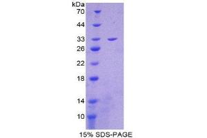 SDS-PAGE (SDS) image for Citrate Synthase (CS) (AA 174-428) protein (His tag) (ABIN2124347)