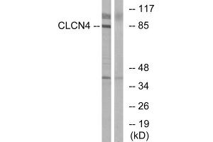Western blot analysis of extracts from MCF-7 cells, using CLCN4 antibody. (CLCN4 抗体  (Internal Region))