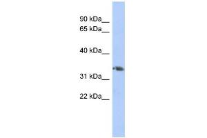 WB Suggested Anti-HOXD10 Antibody Titration:  0. (HOXD10 抗体  (Middle Region))