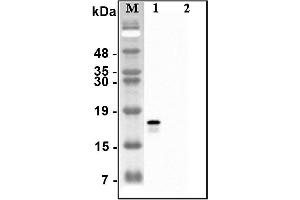 Western blot analysis of recombinant human CTRPs using anti-CTRP2 (human), pAb  at 1:4,000 dilution. (C1QTNF2 抗体)