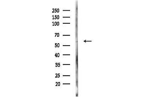Western blot analysis of lysates from 3-L1 cells(heat-shock,45 min treatment), using CYR4 Antibody at 1/1000 dilution.
