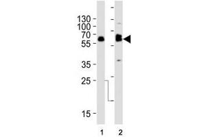 Western blot analysis of lysate from (1) SW480 and (2) U-87 MG cell line using TH antibody at 1:1000. (Tyrosine Hydroxylase 抗体  (AA 486-514))