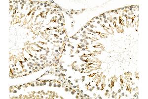 ABIN6258294 and ABIN6275734 at 1/100 staining Rat testis tissue by IHC-P.