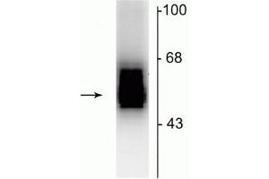 Western blot of 7 µg of rat cerebellar lysate showing specific immunolabeling of the ~55 kDa β2-subunit of the GABAA-R.