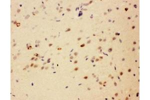 IHC testing of FFPE rat brain with SIP antibody. (CACYBP 抗体  (Middle Region))