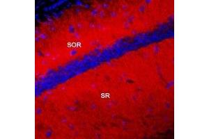 Immunohistochemistry (IHC) image for anti-Potassium Voltage-Gated Channel, Shal-Related Subfamily, Member 2 (KCND2) (AA 454-469), (Intracellular) antibody (ABIN7043533)