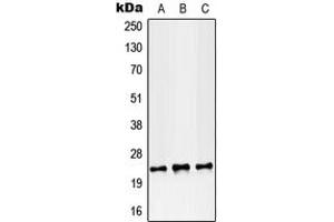 Western blot analysis of RAB38 expression in MCF7 (A), SP2/0 (B), PC12 (C) whole cell lysates. (RAB38 抗体  (Center))