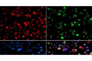 Immunofluorescence analysis of GFP-RNF168 transgenic U2OS cells using PNKP Polyclonal Antibody (PNKP 抗体)