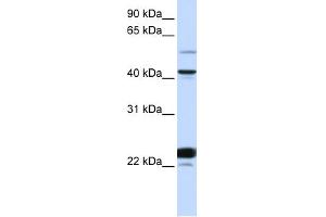 WB Suggested Anti-EVX1 Antibody Titration: 0. (EVX1 抗体  (N-Term))