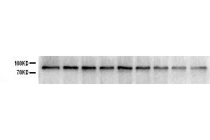 Western blot analysis of SOX5 using anti-SOX5 antibody . (SOX5 抗体  (C-Term))