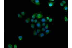 Immunofluorescence staining of Hela cells with ABIN7154719 at 1:166, counter-stained with DAPI. (GNAT3 抗体  (AA 2-354))