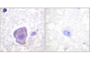 Immunohistochemistry analysis of paraffin-embedded human brain tissue, using FAK (Ab-910) Antibody. (FAK 抗体  (AA 876-925))