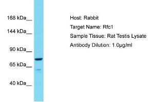 Western Blotting (WB) image for anti-Replication Factor C (Activator 1) 1, 145kDa (RFC1) (C-Term) antibody (ABIN2786752)