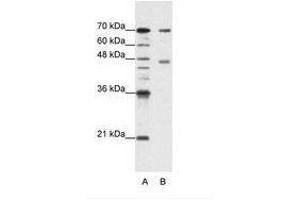 Image no. 2 for anti-Poly(A) Binding Protein, Cytoplasmic 4 (Inducible Form) (PABPC4) (AA 181-230) antibody (ABIN202848)