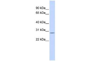 Western Blotting (WB) image for anti-Enoyl CoA Hydratase, Short Chain, 1, Mitochondrial (ECHS1) (N-Term) antibody (ABIN631063)