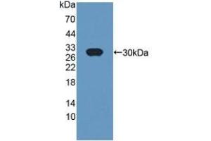 Detection of Recombinant CRISP1, Rat using Polyclonal Antibody to Cysteine Rich Secretory Protein 1 (CRISP1) (CRISP1 抗体  (AA 20-246))