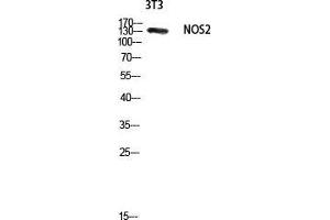 Western Blotting (WB) image for anti-Nitric Oxide Synthase 2, Inducible (NOS2) (Thr177) antibody (ABIN3185936)