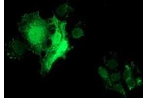 Anti-FHL1 mouse monoclonal antibody (ABIN2453042) immunofluorescent staining of COS7 cells transiently transfected by pCMV6-ENTRY FHL1 (RC203478). (FHL1 抗体)
