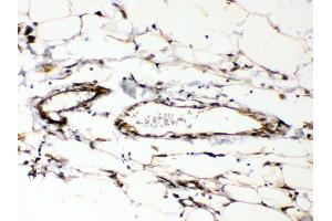 Immunohistochemistry (IHC) image for anti-Cyclophilin B (PPIB) (AA 158-216) antibody (ABIN5519055)