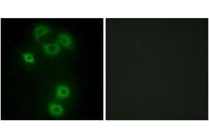 Immunofluorescence analysis of A549 cells, using BMX Antibody. (BMX 抗体  (AA 11-60))