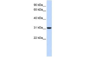 Western Blotting (WB) image for anti-Carbonic Anhydrase VIII (CA8) antibody (ABIN2458629) (CA8 抗体)
