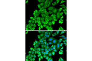 Immunofluorescence (IF) image for anti-Proteasome (Prosome, Macropain) Subunit, beta Type, 4 (PSMB4) antibody (ABIN1876898) (PSMB4 抗体)