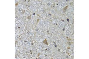 Immunohistochemistry of paraffin-embedded mouse brain using CHN1 antibody (ABIN5974737) at dilution of 1/100 (40x lens). (CHN1 抗体)