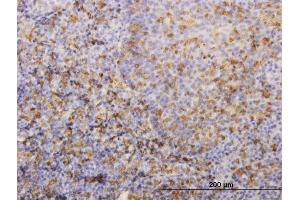 Immunoperoxidase of monoclonal antibody to HLA-DRB4 on formalin-fixed paraffin-embedded human tonsil.