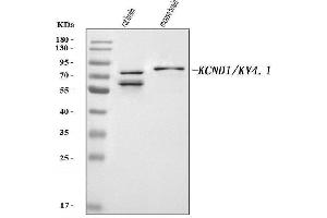 Western blot analysis of KCND1 using anti-KCND1 antibody (ABIN7602352).