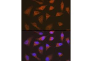 Immunofluorescence analysis of HeLa cells using CDKN2C/p18-INK4C Rabbit mAb  at dilution of 1:100 (40x lens). (CDKN2C 抗体)