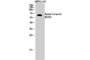 Western Blotting (WB) image for anti-Cortactin (CTTN) (acLys235) antibody (ABIN3178875) (Cortactin 抗体  (acLys235))