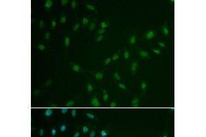 Immunofluorescence analysis of A549 cells using HSF2 Polyclonal Antibody (HSF2 抗体)