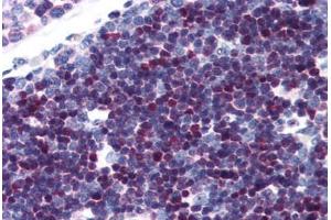 Human Thymus (formalin-fixed, paraffin-embedded) stained with SATB1 antibody ABIN343896 at 5 ug/ml followed by biotinylated goat anti-rabbit IgG secondary antibody ABIN481713, alkaline phosphatase-streptavidin and chromogen. (SATB1 抗体  (C-Term))